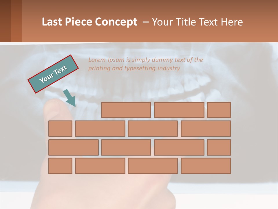 A Person Holding Their Hand Up In Front Of A X - Ray PowerPoint Template