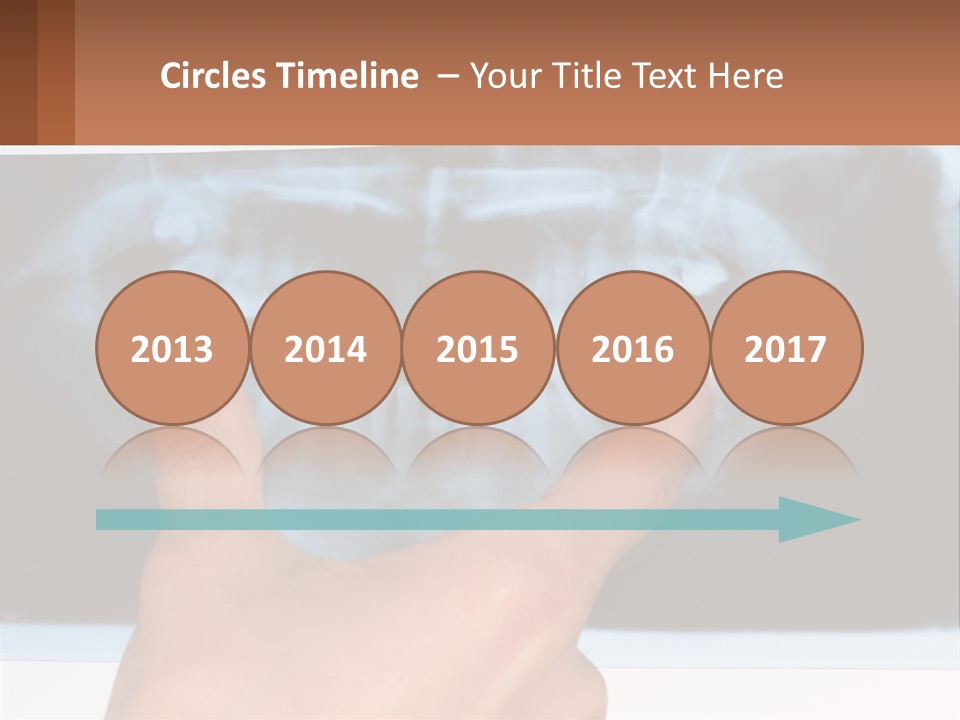 A Person Holding Their Hand Up In Front Of A X - Ray PowerPoint Template