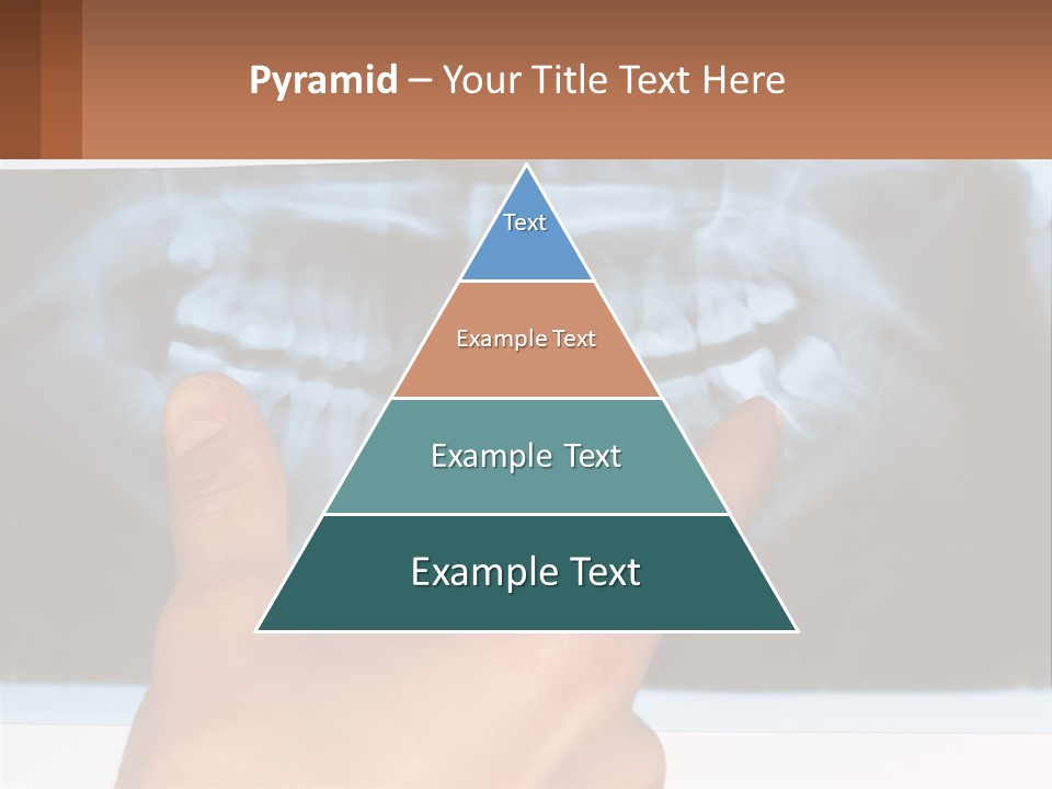 A Person Holding Their Hand Up In Front Of A X - Ray PowerPoint Template