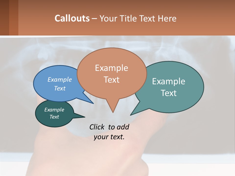 A Person Holding Their Hand Up In Front Of A X - Ray PowerPoint Template