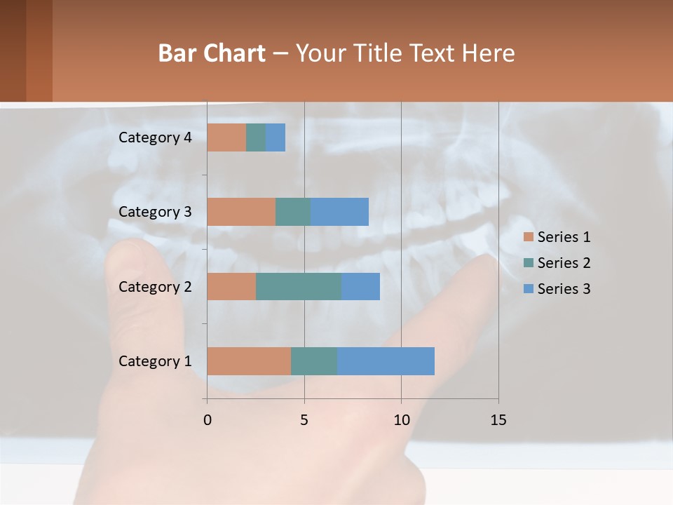 A Person Holding Their Hand Up In Front Of A X - Ray PowerPoint Template