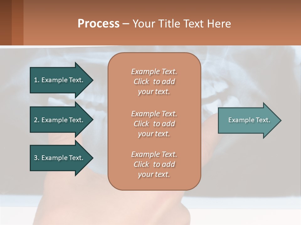 A Person Holding Their Hand Up In Front Of A X - Ray PowerPoint Template