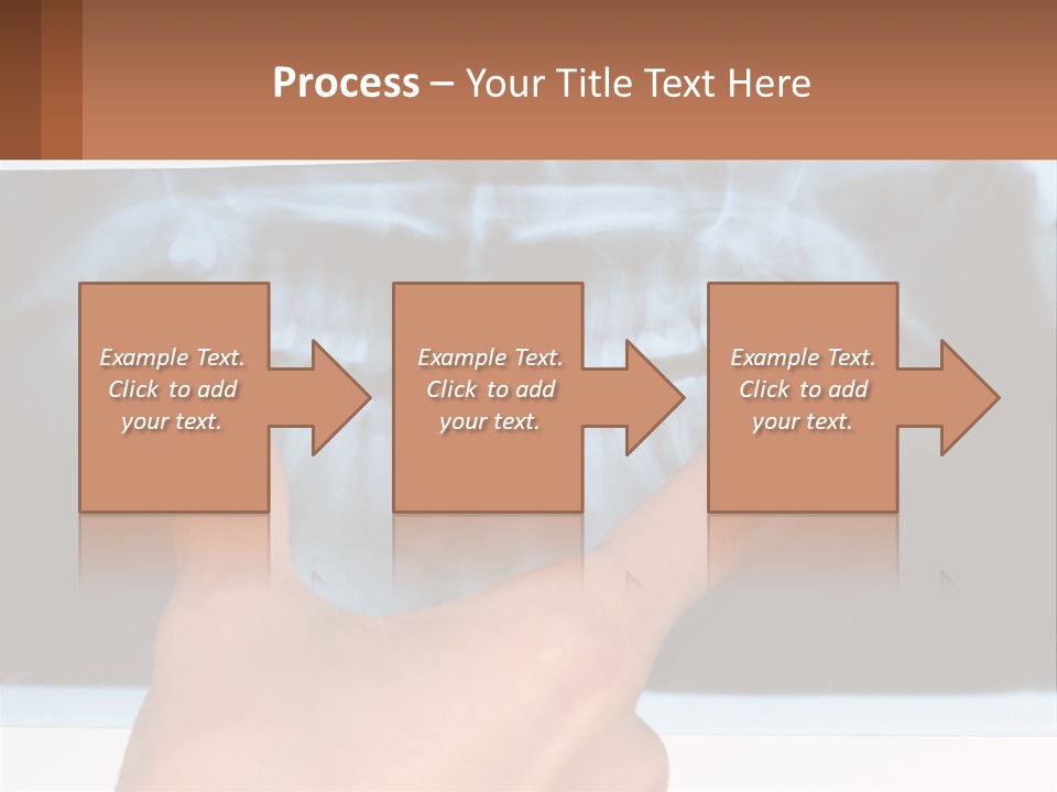 A Person Holding Their Hand Up In Front Of A X - Ray PowerPoint Template