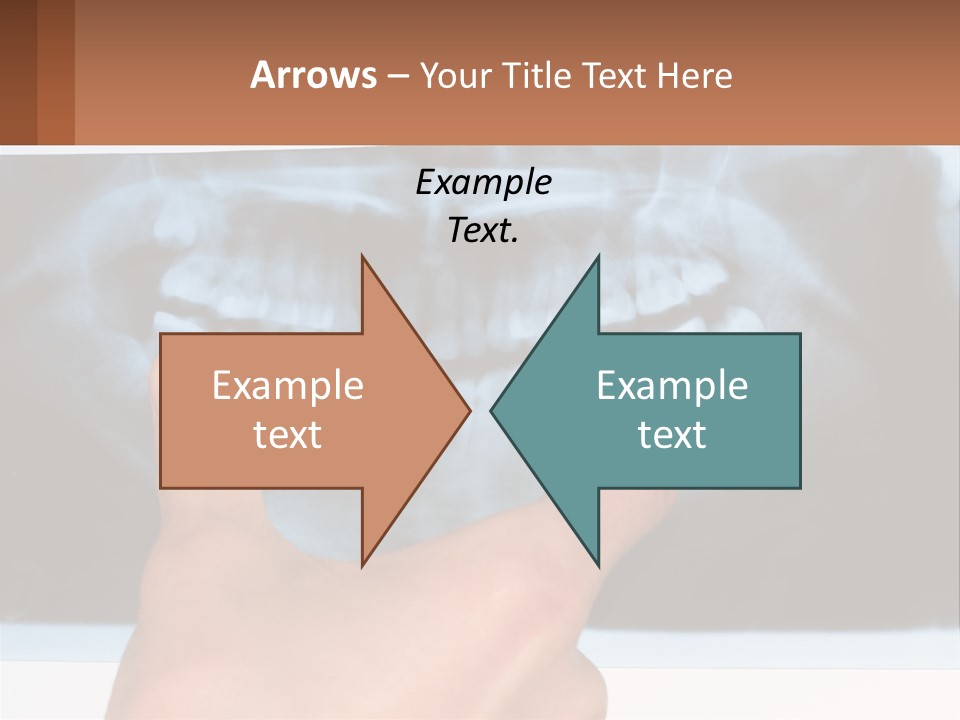 A Person Holding Their Hand Up In Front Of A X - Ray PowerPoint Template