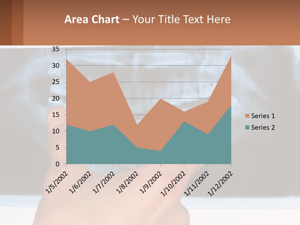 A Person Holding Their Hand Up In Front Of A X - Ray PowerPoint Template