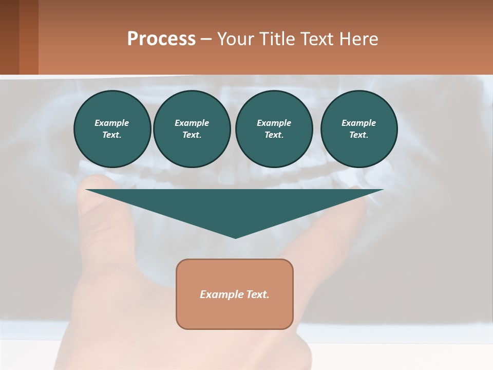 A Person Holding Their Hand Up In Front Of A X - Ray PowerPoint Template