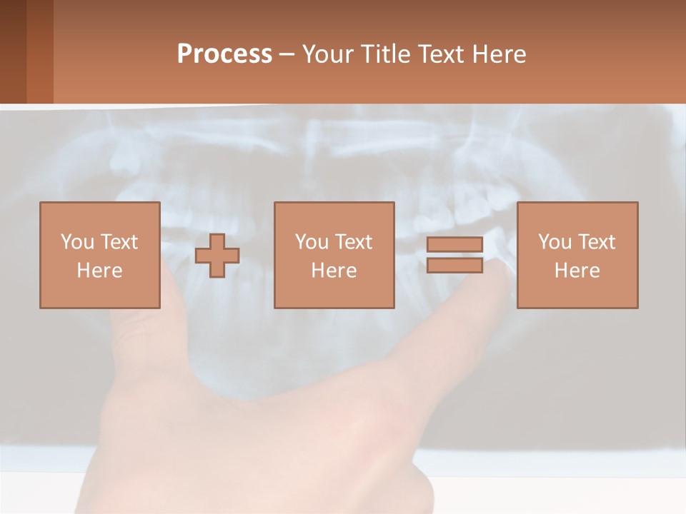 A Person Holding Their Hand Up In Front Of A X - Ray PowerPoint Template
