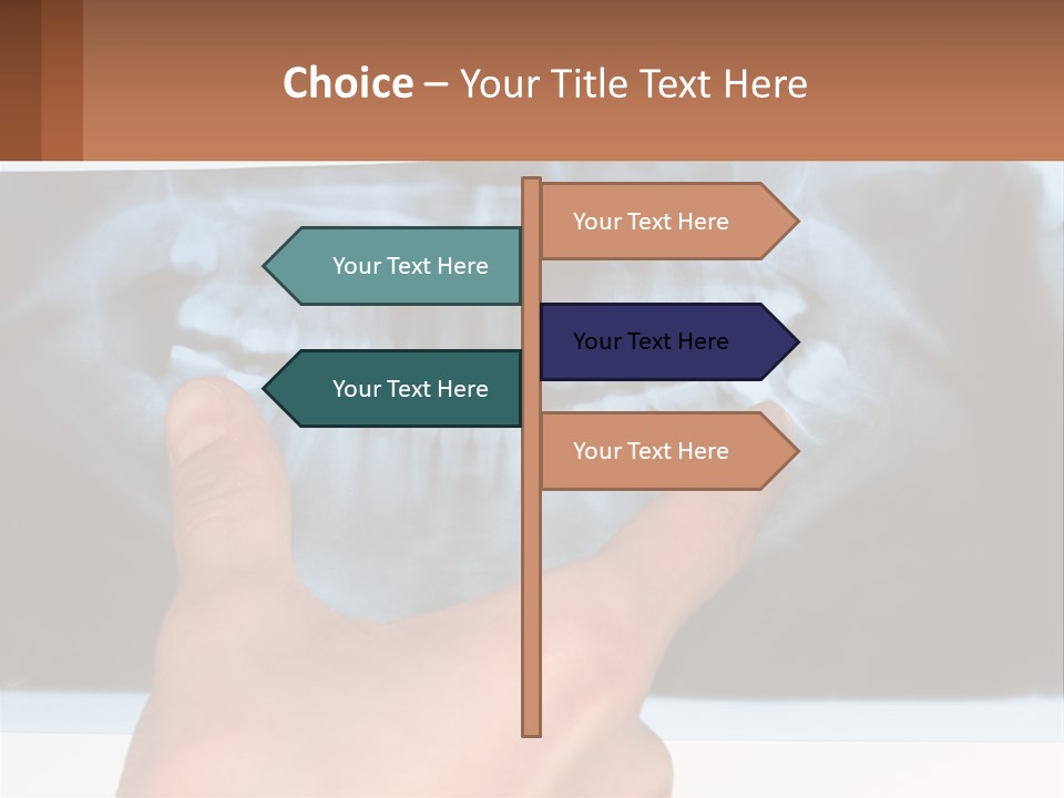 A Person Holding Their Hand Up In Front Of A X - Ray PowerPoint Template