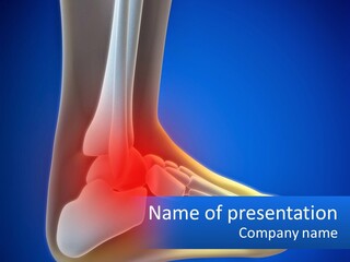 A Medical Powerpoint Presentation With A Highlighted Image Of A Foot PowerPoint Template