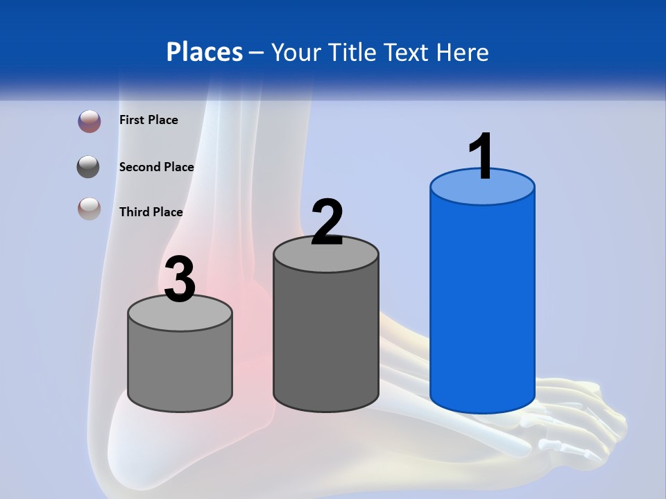 A Medical Powerpoint Presentation With A Highlighted Image Of A Foot PowerPoint Template