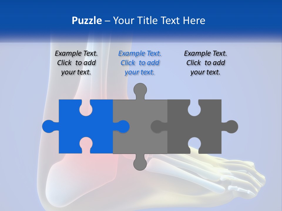 A Medical Powerpoint Presentation With A Highlighted Image Of A Foot PowerPoint Template