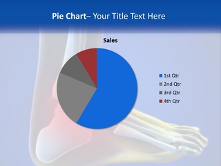 A Medical Powerpoint Presentation With A Highlighted Image Of A Foot PowerPoint Template