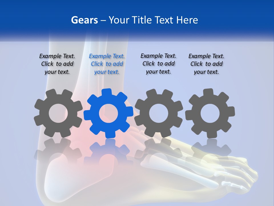 A Medical Powerpoint Presentation With A Highlighted Image Of A Foot PowerPoint Template