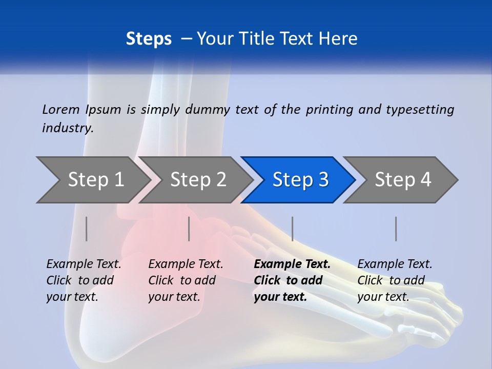 A Medical Powerpoint Presentation With A Highlighted Image Of A Foot PowerPoint Template