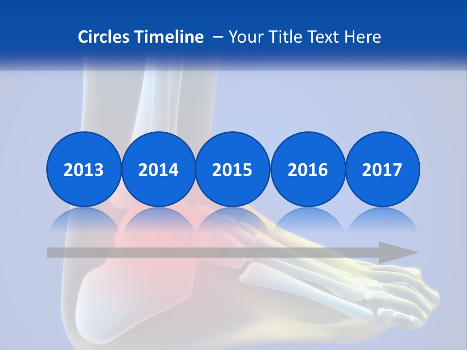 A Medical Powerpoint Presentation With A Highlighted Image Of A Foot PowerPoint Template