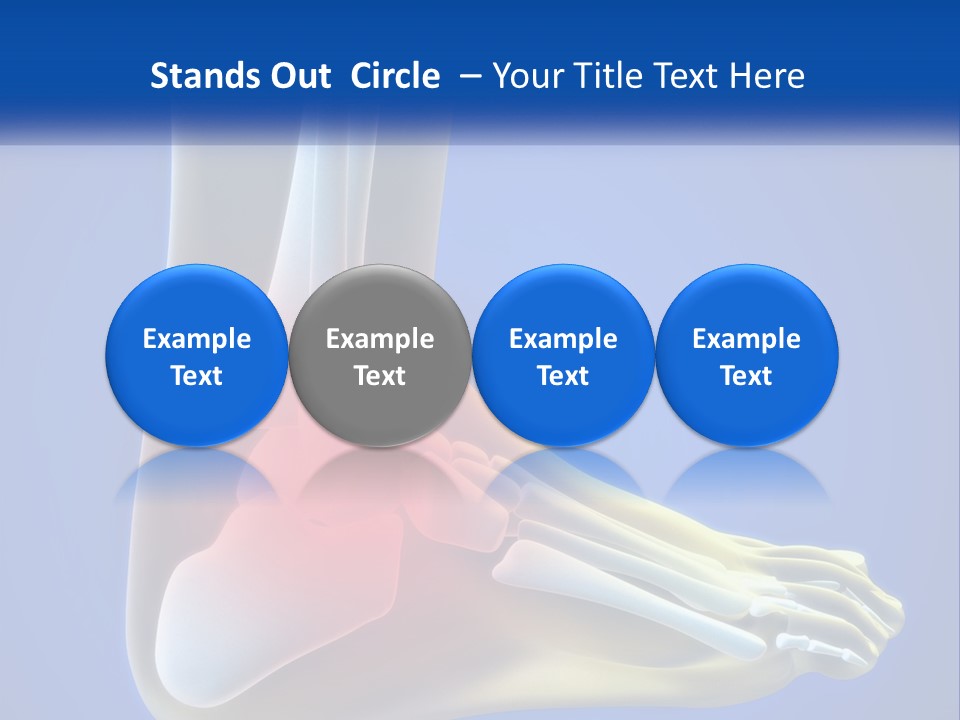 A Medical Powerpoint Presentation With A Highlighted Image Of A Foot PowerPoint Template