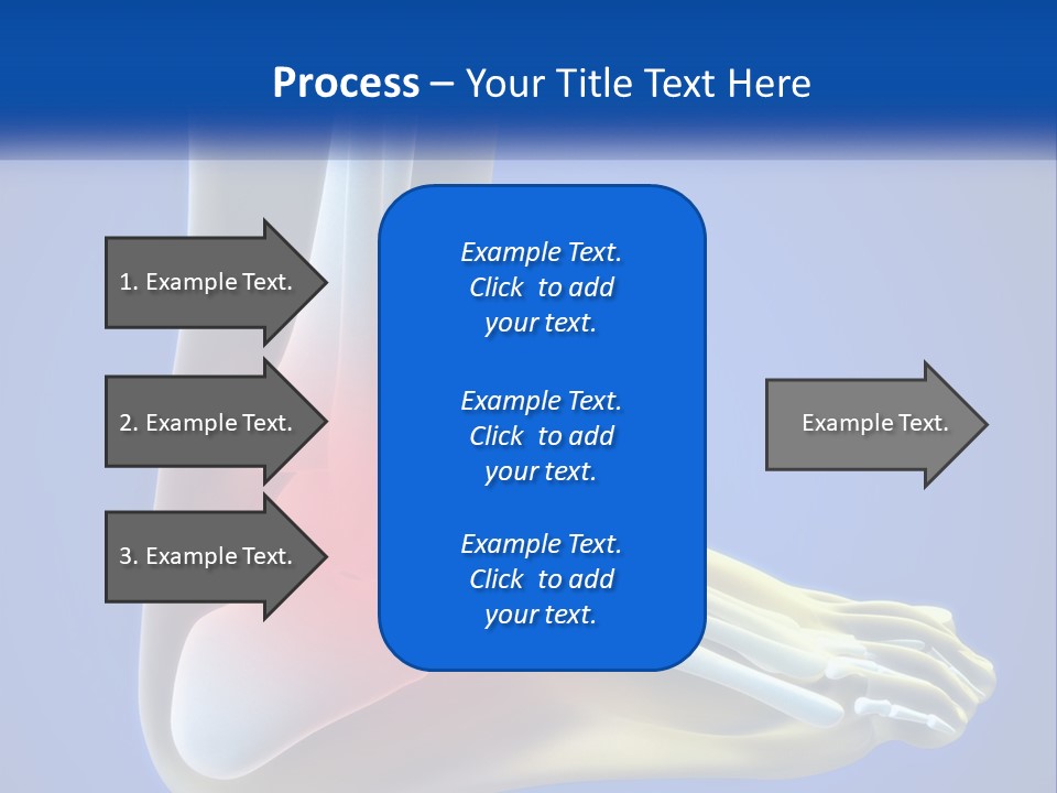 A Medical Powerpoint Presentation With A Highlighted Image Of A Foot PowerPoint Template