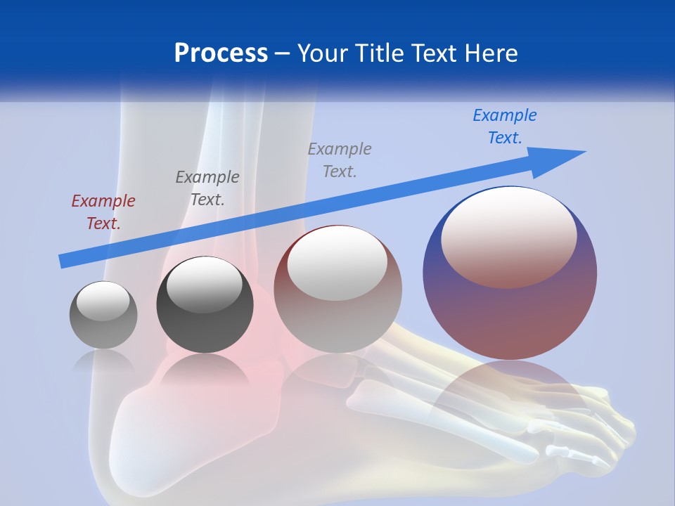 A Medical Powerpoint Presentation With A Highlighted Image Of A Foot PowerPoint Template