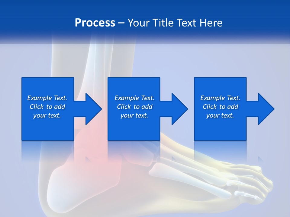 A Medical Powerpoint Presentation With A Highlighted Image Of A Foot PowerPoint Template