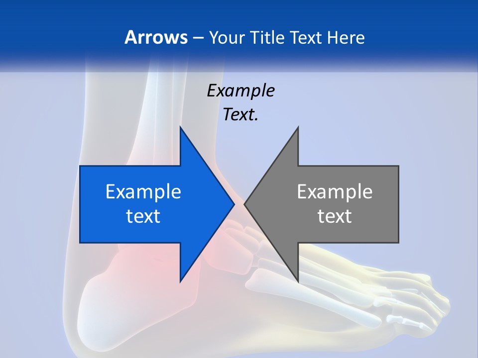 A Medical Powerpoint Presentation With A Highlighted Image Of A Foot PowerPoint Template