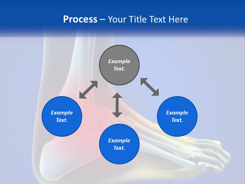 A Medical Powerpoint Presentation With A Highlighted Image Of A Foot PowerPoint Template