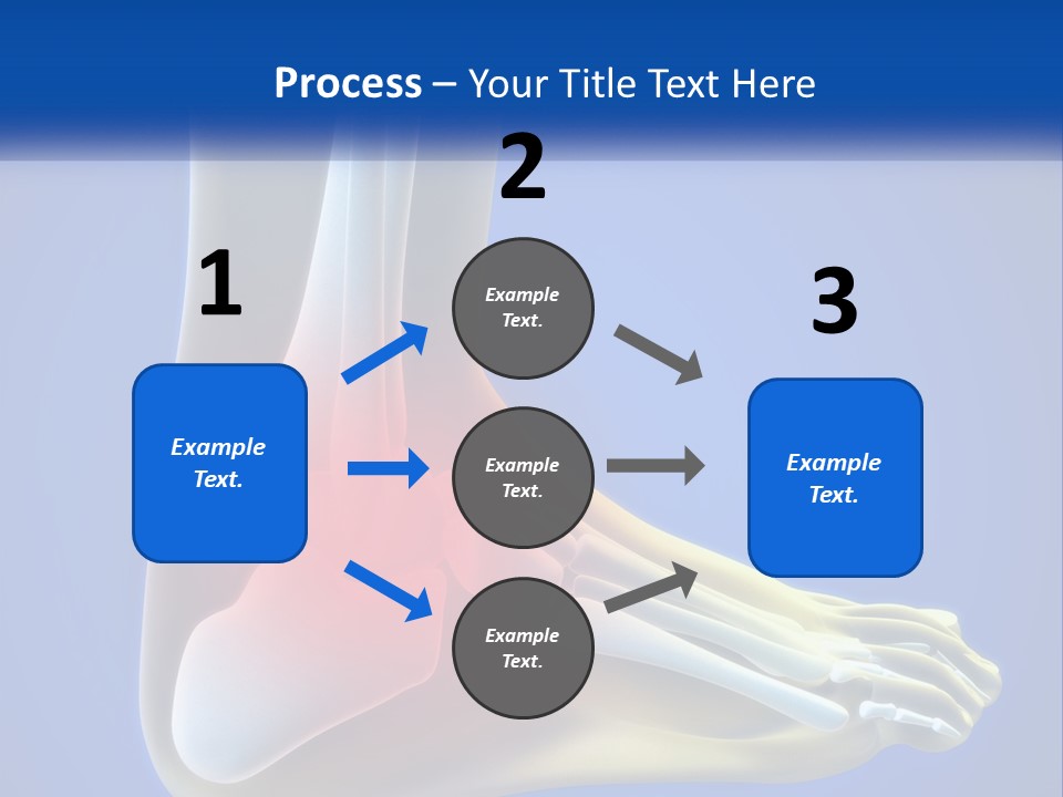 A Medical Powerpoint Presentation With A Highlighted Image Of A Foot PowerPoint Template