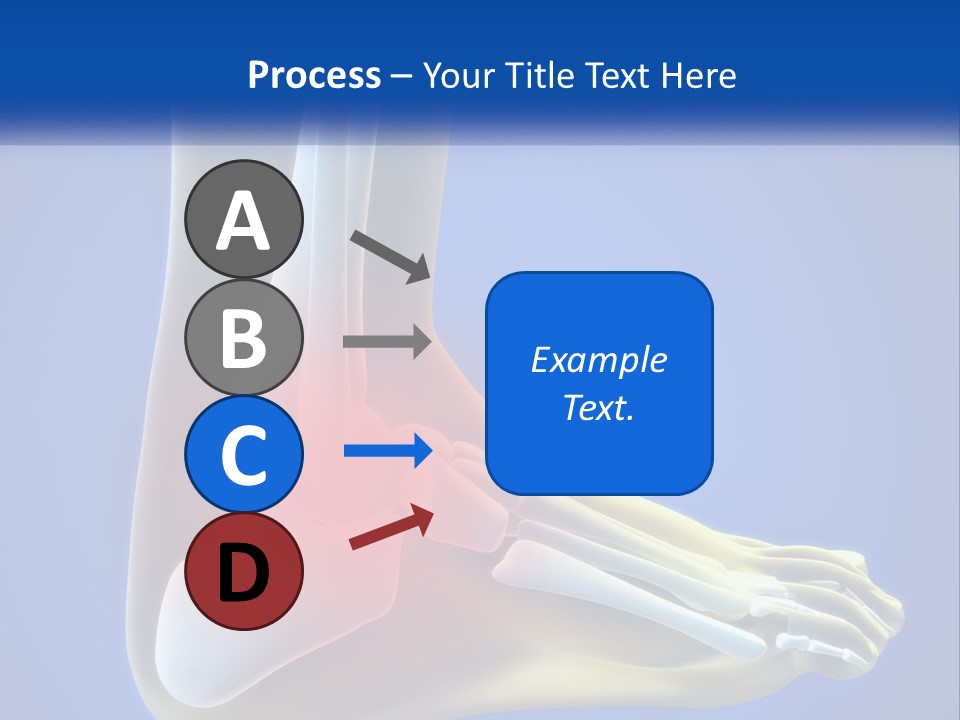A Medical Powerpoint Presentation With A Highlighted Image Of A Foot PowerPoint Template