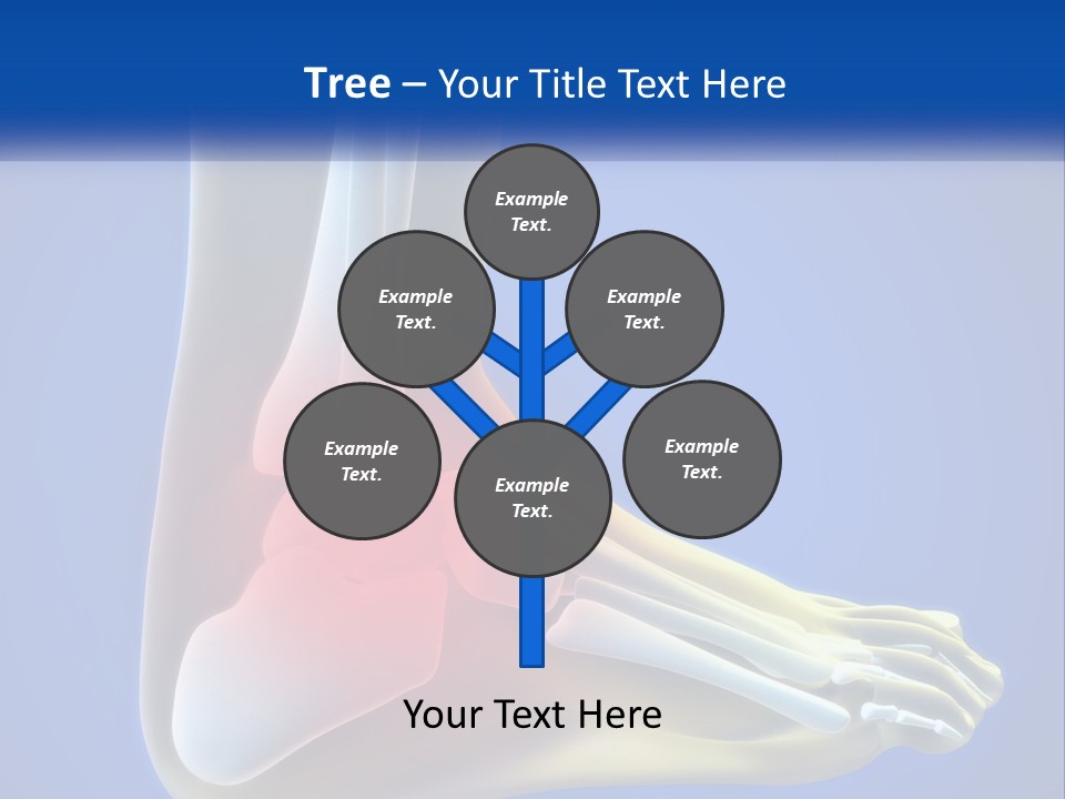 A Medical Powerpoint Presentation With A Highlighted Image Of A Foot PowerPoint Template