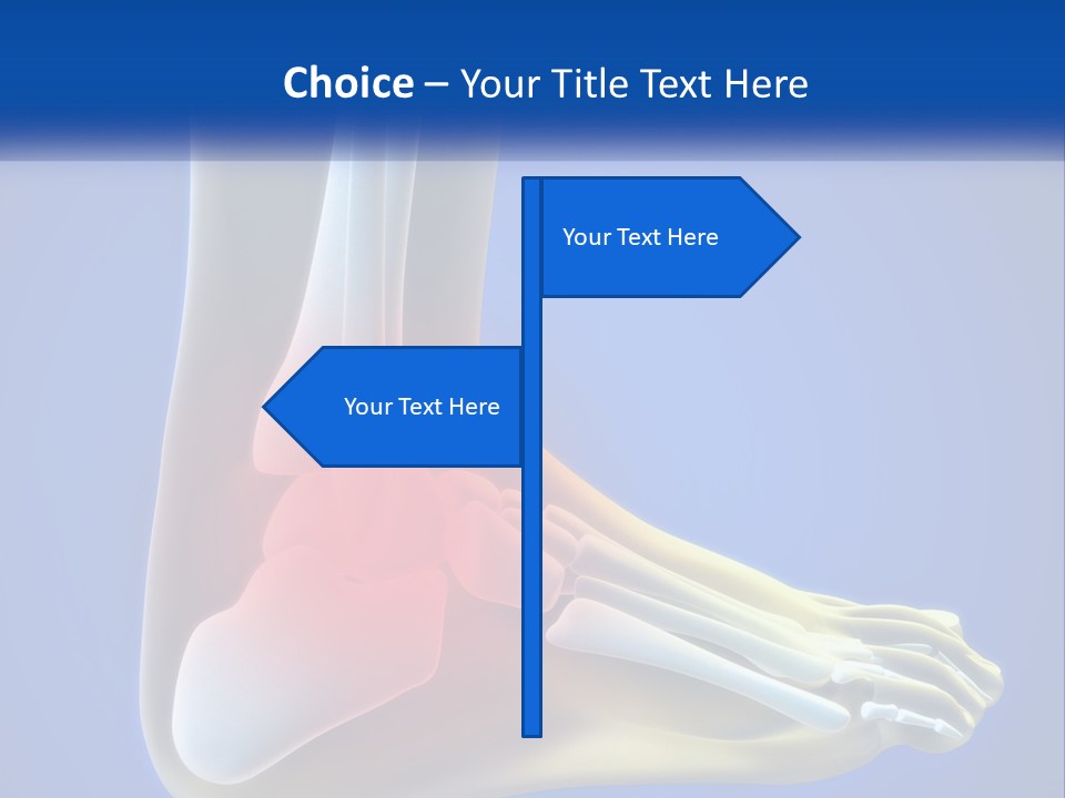A Medical Powerpoint Presentation With A Highlighted Image Of A Foot PowerPoint Template