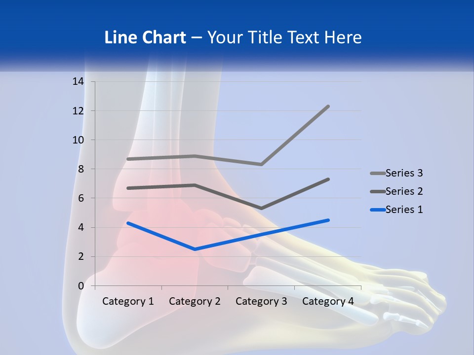 A Medical Powerpoint Presentation With A Highlighted Image Of A Foot PowerPoint Template