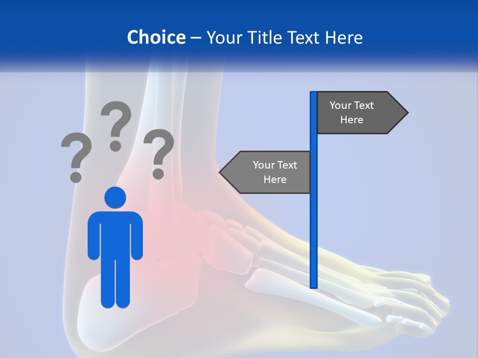 A Medical Powerpoint Presentation With A Highlighted Image Of A Foot PowerPoint Template
