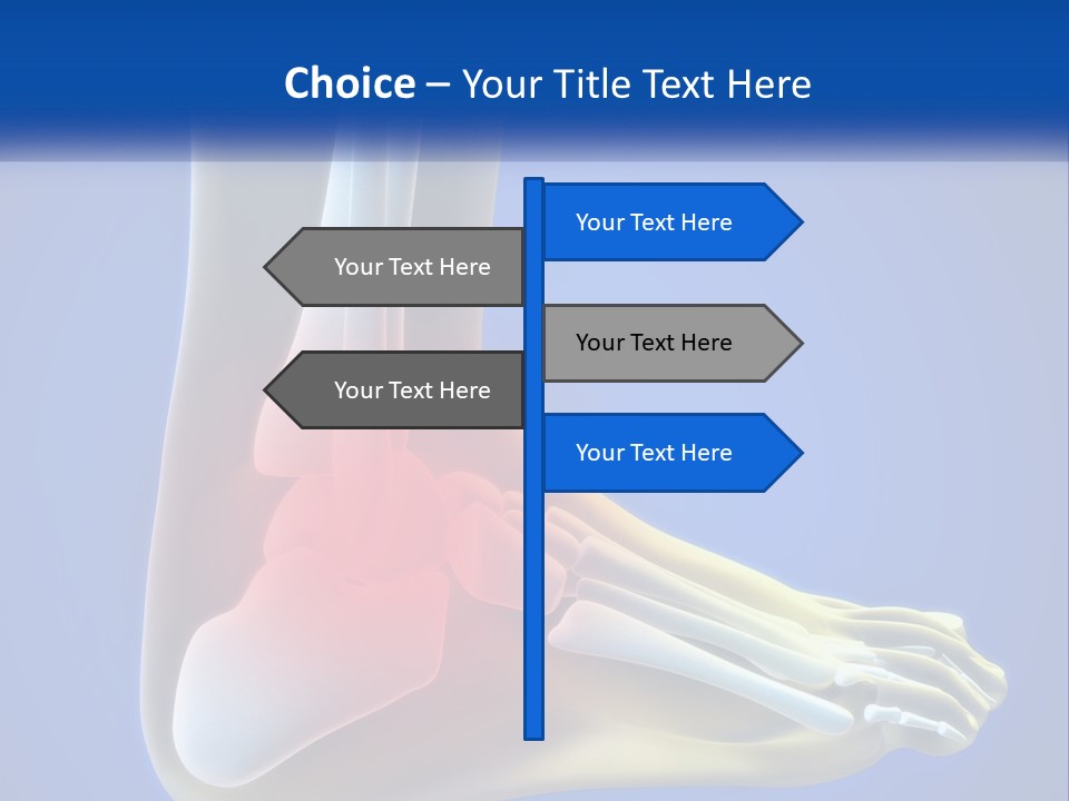 A Medical Powerpoint Presentation With A Highlighted Image Of A Foot PowerPoint Template