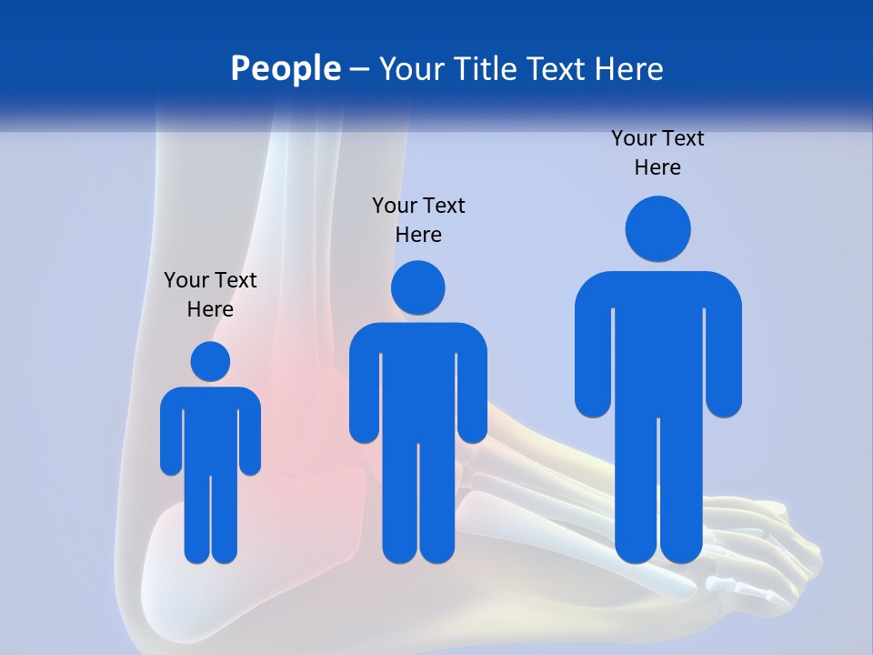A Medical Powerpoint Presentation With A Highlighted Image Of A Foot PowerPoint Template