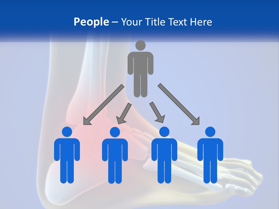 A Medical Powerpoint Presentation With A Highlighted Image Of A Foot PowerPoint Template