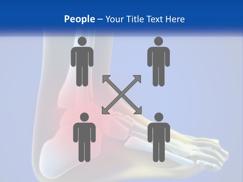 A Medical Powerpoint Presentation With A Highlighted Image Of A Foot PowerPoint Template