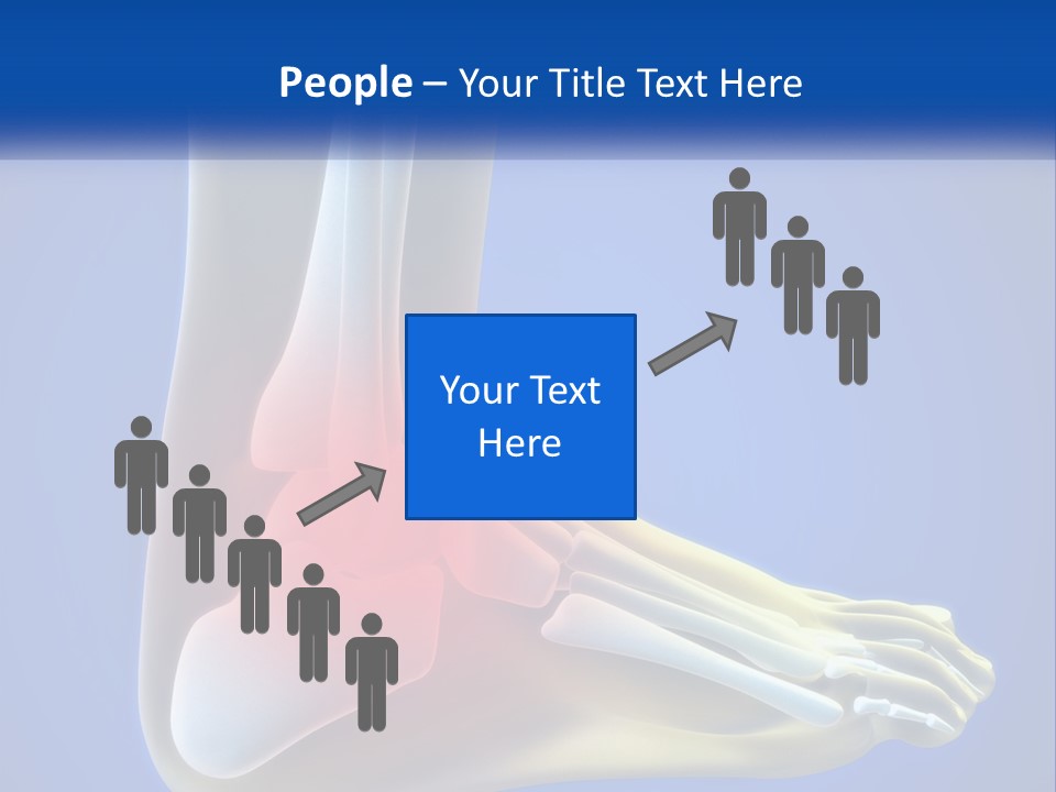 A Medical Powerpoint Presentation With A Highlighted Image Of A Foot PowerPoint Template
