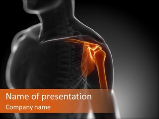 A Skeleton With A Highlighted Shoulder Powerpoint Presentation PowerPoint Template
