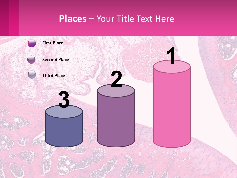 An Image Of A Section Of The Stomach With The Name Of The Organ PowerPoint Template