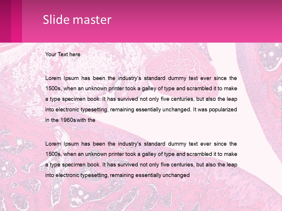 An Image Of A Section Of The Stomach With The Name Of The Organ PowerPoint Template