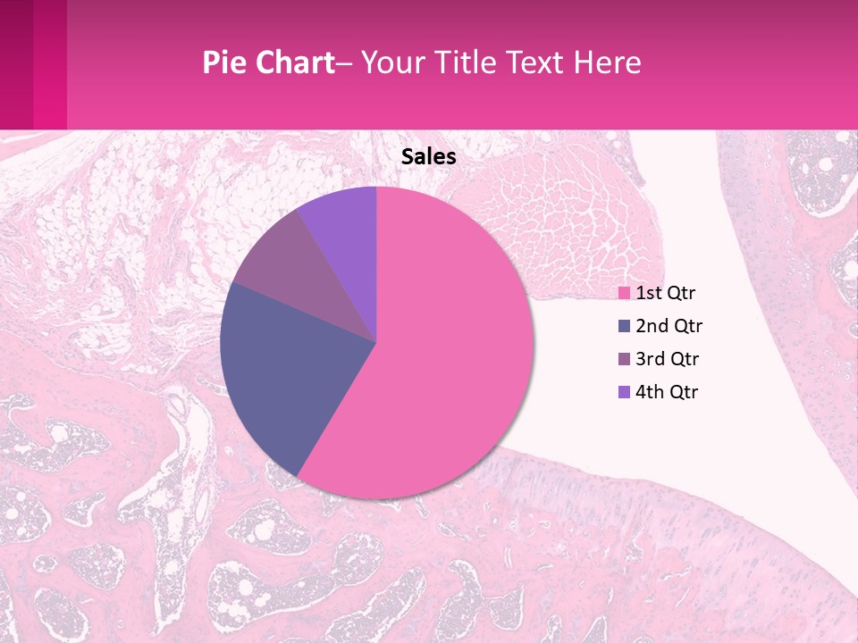 An Image Of A Section Of The Stomach With The Name Of The Organ PowerPoint Template