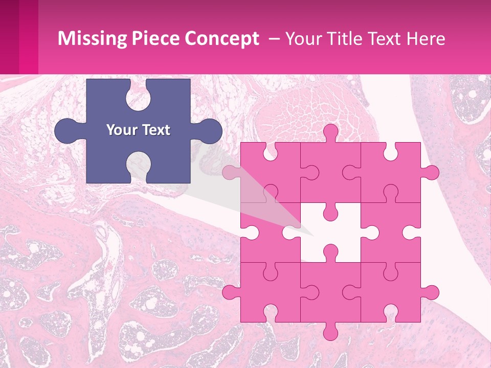 An Image Of A Section Of The Stomach With The Name Of The Organ PowerPoint Template