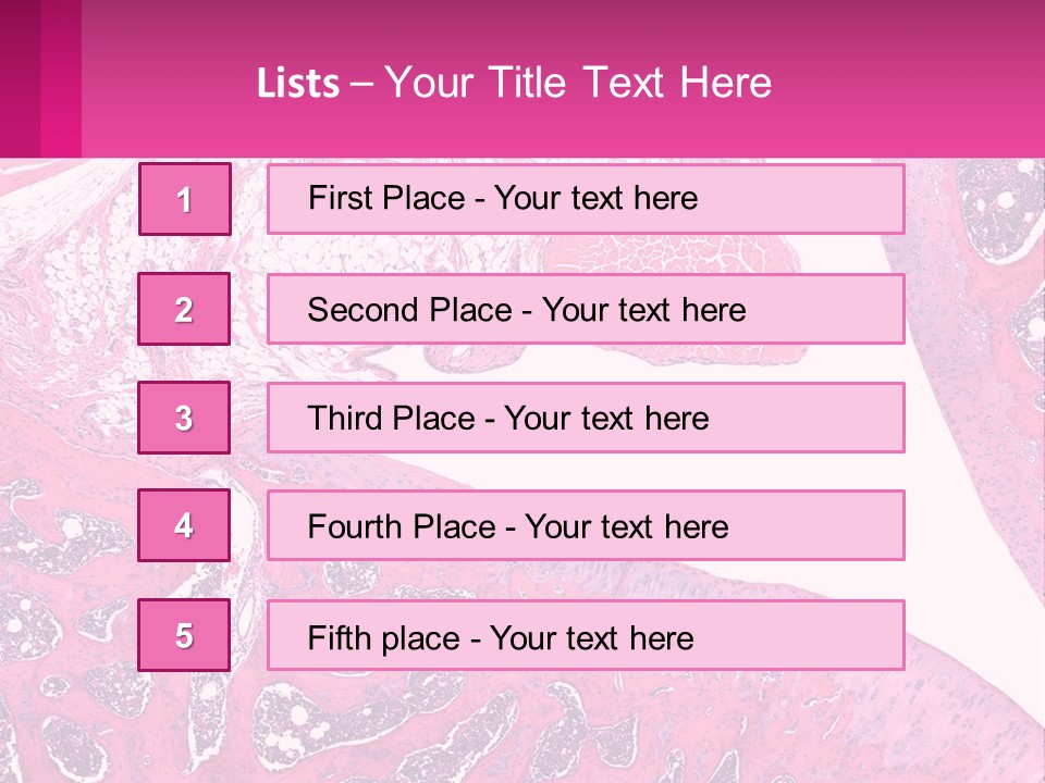 An Image Of A Section Of The Stomach With The Name Of The Organ PowerPoint Template