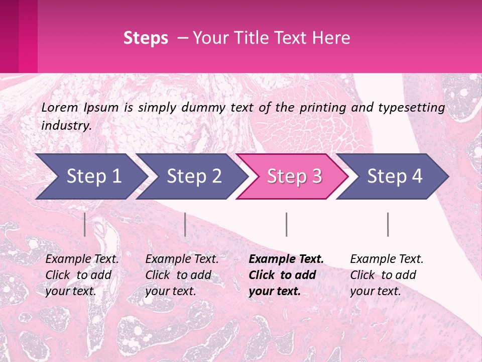 An Image Of A Section Of The Stomach With The Name Of The Organ PowerPoint Template
