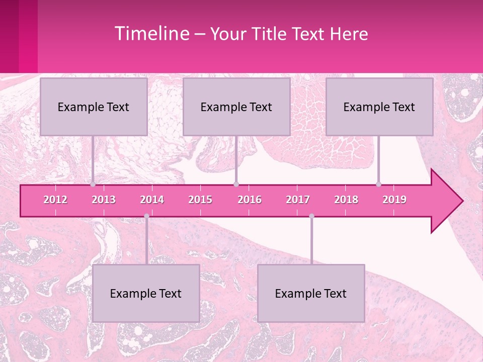 An Image Of A Section Of The Stomach With The Name Of The Organ PowerPoint Template