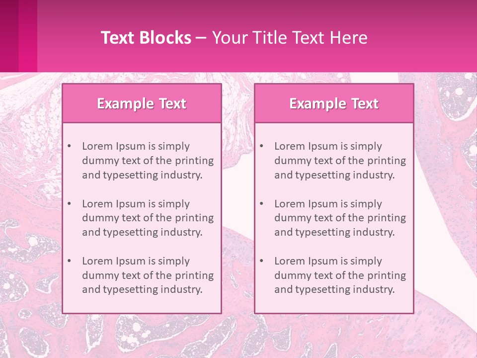 An Image Of A Section Of The Stomach With The Name Of The Organ PowerPoint Template