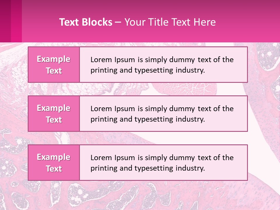 An Image Of A Section Of The Stomach With The Name Of The Organ PowerPoint Template