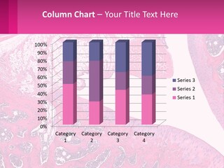 An Image Of A Section Of The Stomach With The Name Of The Organ PowerPoint Template