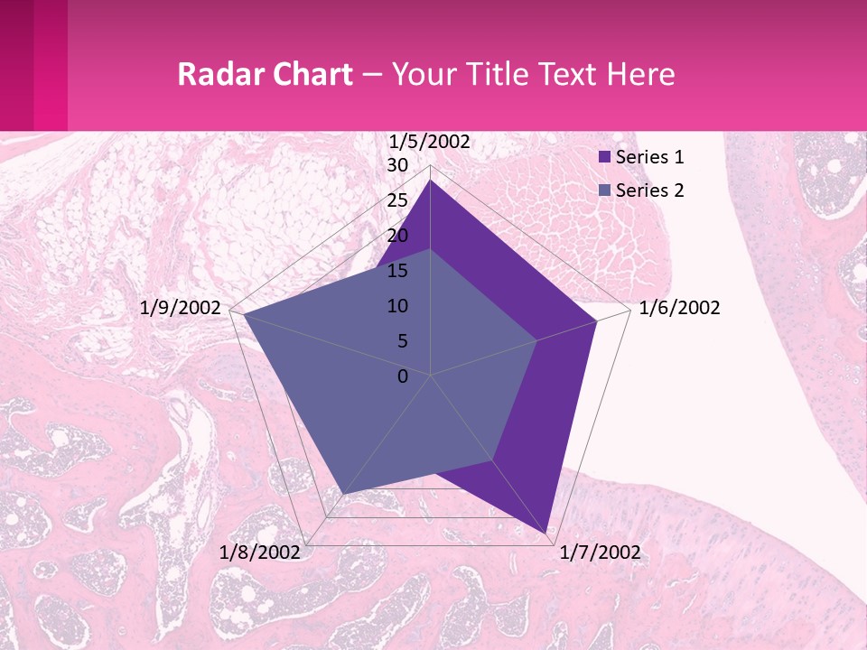 An Image Of A Section Of The Stomach With The Name Of The Organ PowerPoint Template