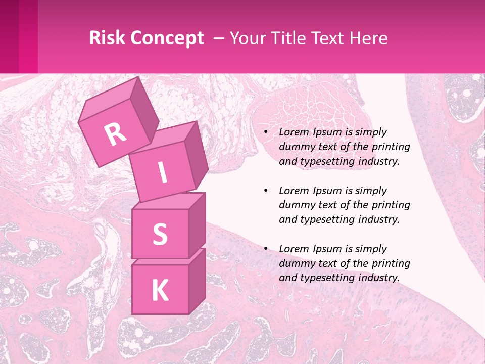 An Image Of A Section Of The Stomach With The Name Of The Organ PowerPoint Template