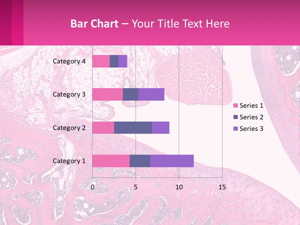 An Image Of A Section Of The Stomach With The Name Of The Organ PowerPoint Template